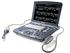 VOLUSON i Portible Ultrasound System