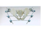 Pelvic External Fixator