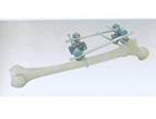 Proximal Femur External Fixator