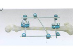 Half Ring(Standard) External Fixator