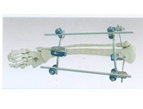 Proximal Tibia External Fixator