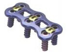 Anterior Cervical Plate II