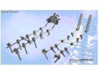 Nail Rod System