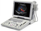 Z5 portable color doppler