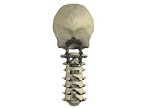 ATON cervical occipital plate