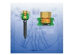 UPASS 5.5 screw system