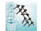 SINO 6.0 screw system