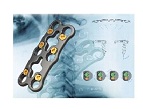 CERVI-LOCK Anterior Cervical Plate