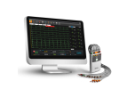 SE-1515 ECG