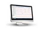 Smart ECG Viewer