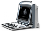 ECO5 Portable Color Doppler