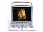 Q5 4D Color Doppler Portable