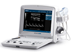 DUS60 Portable Ultrasound