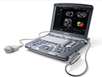 VOLUSON E Portible System