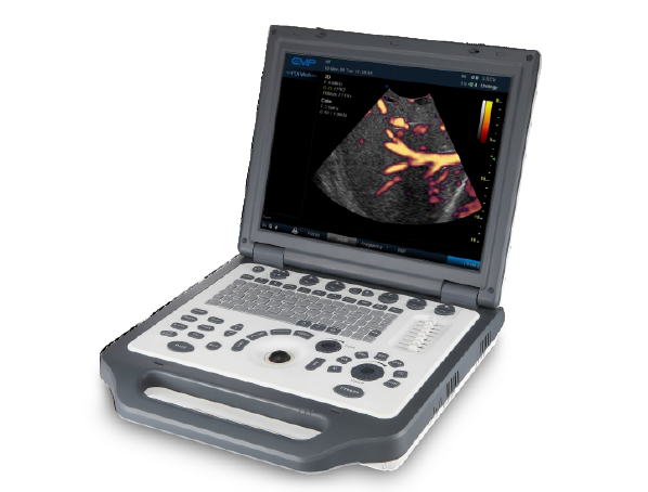 G30 portable color doppler