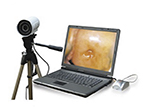 9800 Vagina Portable Electronic Colposcope