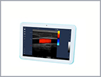 RT1 Full Touch Screen Color Doppler